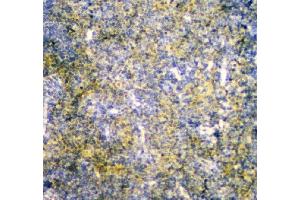 IHC analysis of MPI using anti-MPI antibody (ABIN4886672).