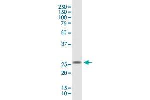TMEM81 monoclonal antibody (M05), clone 3D5. (TMEM81 抗体  (AA 1-255))