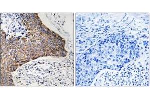 Immunohistochemistry analysis of paraffin-embedded human tonsil tissue, using C1QBP Antibody. (C1QBP 抗体  (AA 61-110))