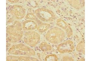 Immunohistochemistry of paraffin-embedded human kidney tissue using ABIN7175143 at dilution of 1:100 (Uroplakin 3A 抗体  (AA 19-207))