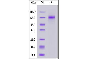 SDS-PAGE (SDS) image for delta Like Protein 3 (DLL3) (AA 27-490) (Active) protein (His tag) (ABIN6992335)