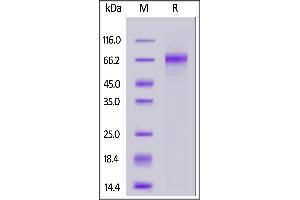Cynomolgus DLL3, His Tag on  under reducing (R) condition. (DLL3 Protein (AA 27-490) (His tag))