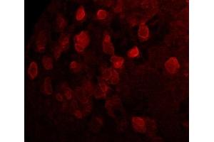 Immunofluorescence (IF) image for anti-Sarcolemma Associated Protein (SLMAP) (N-Term) antibody (ABIN7273079) (SLMAP 抗体  (N-Term))