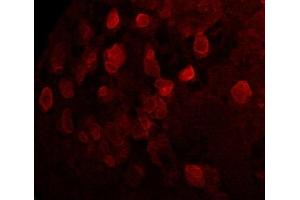 Immunofluorescence (IF) image for anti-Sarcolemma Associated Protein (SLMAP) (N-Term) antibody (ABIN7273079)