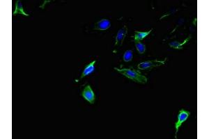 Immunofluorescent analysis of Hela cells using ABIN7143907 at dilution of 1:100 and Alexa Fluor 488-congugated AffiniPure Goat Anti-Rabbit IgG(H+L) (AMACR 抗体  (AA 13-175))