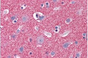 Immunohistochemistry (IHC) image for anti-Septin 3 (SEPT3) (N-Term) antibody (ABIN184733)