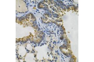 Immunohistochemistry of paraffin-embedded mouse lung using AKR1B1 Antibody. (AKR1B1 抗体  (AA 1-316))