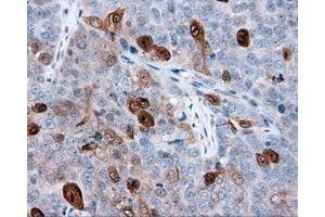 Immunohistochemical staining of paraffin-embedded Kidney tissue using anti-ANXA1 mouse monoclonal antibody. (Annexin a1 抗体)