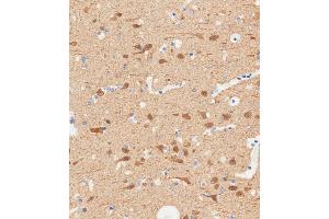 Immunohistochemical analysis of paraffin-embedded Human brain tissue using A performed on the Leica® BOND RXm. (TUBB2B 抗体  (N-Term))
