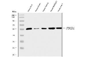 Western blot analysis of PD1/Pdcd1 using anti-PD1/Pdcd1 antibody (ABIN7601831). (PD-1 抗体  (AA 48-288))
