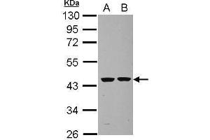 WB Image Sample (30 ug of whole cell lysate) A: U87-MG B: SK-N-SH 10% SDS PAGE antibody diluted at 1:1000 (Septin 2 抗体)
