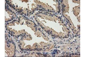 Image no. 1 for anti-Acyl-CoA Thioesterase 12 (ACOT12) antibody (ABIN1496415) (ACOT12 抗体)