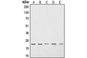 Western blot analysis of CSRP1 expression in Jurkat (A), HeLa (B), PC3 (C), DU145 (D), A10 (E) whole cell lysates.
