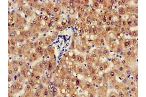 Immunohistochemistry of paraffin-embedded human liver tissue using ABIN7144062 at dilution of 1:100 (ZFAND6 抗体  (AA 1-208))