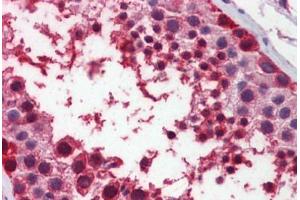 Human Testis: Formalin-Fixed, Paraffin-Embedded (FFPE) (MDM4-binding Protein 抗体  (AA 130-179))
