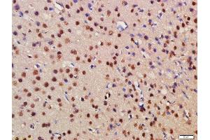 Formalin-fixed and paraffin embedded rat brain labeled with Rabbit Anti-BRD1 Polyclonal Antibody, Unconjugated (ABIN1387435) at 1:200 followed by conjugation to the secondary antibody and DAB staining (BRD1 抗体  (AA 701-800))