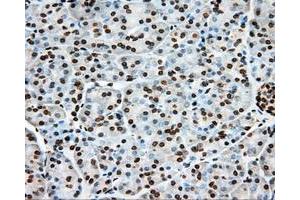 Immunohistochemical staining of paraffin-embedded liver tissue using anti-ERCC1 mouse monoclonal antibody. (ERCC1 抗体)