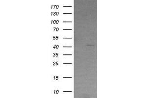 Image no. 1 for anti-Radical S-Adenosyl Methionine Domain Containing 2 (RSAD2) antibody (ABIN1501723) (RSAD2 抗体)