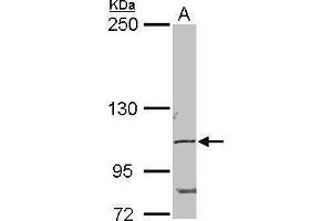Western Blotting (WB) image for anti-POM121 Membrane Glycoprotein (POM121) (N-Term) antibody (ABIN2855297)