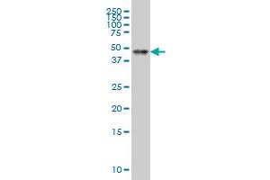 Western Blotting (WB) image for anti-Retinoic Acid Receptor, alpha (RARA) (AA 315-424) antibody (ABIN519635)