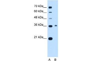 WB Suggested Anti-C11orf54 Antibody Titration:  0. (C11orf54 抗体  (C-Term))