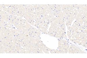 Detection of FGF1 in Caprine Cardiac Muscle Tissue using Polyclonal Antibody to Fibroblast Growth Factor 1, Acidic (FGF1) (FGF1 抗体  (AA 2-155))