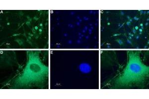 Expression of neuropeptide Y5 receptor in rat DRG - Immunocytochemical staining of a primary culture of rat dorsal root ganglion (DRG) neurons. (NPY5R 抗体  (AA 291-306))