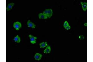 Immunofluorescence staining of HepG2 cells with ABIN7158062 at 1:100, counter-stained with DAPI. (LRTM2 抗体  (AA 36-310))