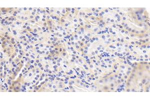 Detection of eNOS in Human Kidney Tissue using Polyclonal Antibody to Endothelial NOS (eNOS) (ENOS 抗体  (AA 756-888))