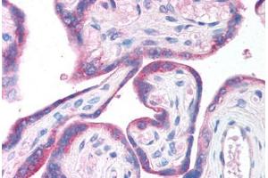 Human Placenta (formalin-fixed, paraffin-embedded) stained with CLIC6 antibody ABIN214747 at 5 ug/ml followed by biotinylated goat anti-rabbit IgG secondary antibody ABIN481713, alkaline phosphatase-streptavidin and chromogen. (CLIC6 抗体  (AA 435-484))