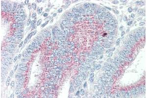 Human Uterus (formalin-fixed, paraffin-embedded) stained with ORAI3 antibody ABIN337113 at 5 ug/ml followed by biotinylated goat anti-rabbit IgG secondary antibody ABIN481713, alkaline phosphatase-streptavidin and chromogen. (ORAI3 抗体  (N-Term))