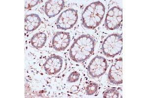 Immunohistochemistry of paraffin-embedded human colon using S100 antibody (ABIN7270126) at dilution of 1:100 (40x lens). (S100A5 抗体  (AA 1-92))