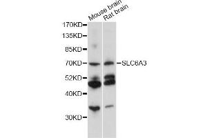 Western blot analysis of extracts of various cell lines, using SLC6A3 antibody (ABIN6291471) at 1:1000 dilution. (SLC6A3 抗体)