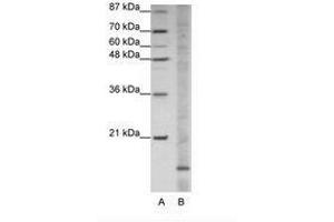Image no. 1 for anti-Apolipoprotein O (APOO) (N-Term) antibody (ABIN202054) (APOO 抗体  (N-Term))