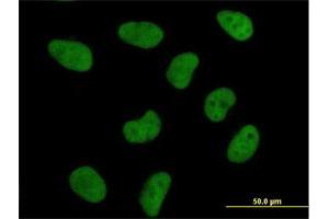 Immunofluorescence of purified MaxPab antibody to DFFA on HeLa cell.