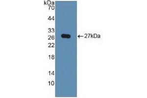 Detection of Recombinant KPNa2, Human using Polyclonal Antibody to Karyopherin Alpha 2 (KPNa2) (KPNA2 抗体  (AA 157-412))