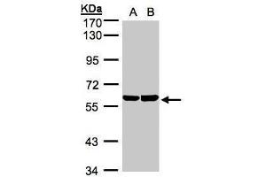 WB Image Sample(30 ug whole cell lysate) A:A431, B:Hep G2 , 7. (TBRG4 抗体)