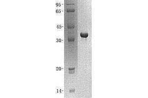 Validation with Western Blot (NAPA Protein (His tag))