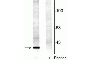 Western blot of rat brainstem lysate showing specific immunolabeling of the ~29 kDa 14-3-3 protein phosphorylated at Ser58 (-). (YWHAB 抗体  (pSer58))