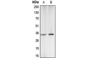 Western blot analysis of Carbonic Anhydrase 5A expression in K562 (A), A549 (B) whole cell lysates. (CA5A 抗体  (Center))
