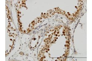 Immunostaining (ISt) image for anti-Poly(rC) Binding Protein 2 (PCBP2) (AA 1-362) antibody (ABIN562121)