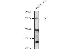 Western blot analysis of extracts of Mouse lung, using SRSF6 antibody (ABIN7270217) at 1:1000 dilution. (SFRS6 抗体  (AA 1-100))