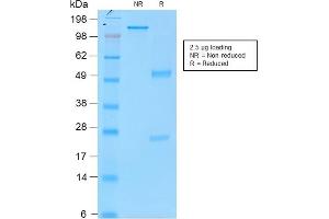 SDS-PAGE Analysis Purified Tyrosinase MouseRecombinantMonoclonal Antibody (rOCA1/812). (Recombinant TYR 抗体)
