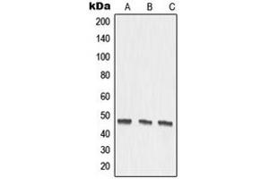 Western blot analysis of MMP27 expression in DLD (A), mouse kidney (B), rat kidney (C) whole cell lysates. (MMP27 抗体  (Center))