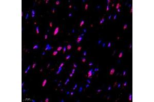 Immunofluorescence (Paraffin-embedded Sections) (IF (p)) image for anti-Ubiquitin Specific Peptidase 24 (USP24) antibody (ABIN7076111)