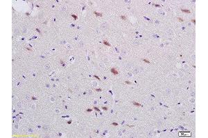 Formalin-fixed and paraffin embedded rat brain labeled with Anti-ADORA1 Polyclonal Antibody, Unconjugated  at 1:200 followed by conjugation to the secondary antibody and DAB staining (ADORA1 抗体  (AA 225-326))