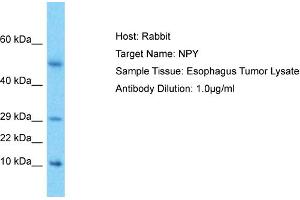 Host: Rabbit Target Name: NPY Sample Type: Esophagus Tumor lysates Antibody Dilution: 1. (NPY 抗体  (Middle Region))