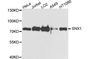 Western blot analysis of extracts of various cell lines, using SNX1 antibody. (Sorting Nexin 1 抗体)