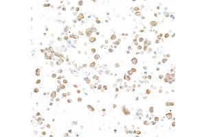 Immunocytochemistry (ICC) image for anti-Ubiquitin Carboxyl-terminal Esterase L1 (Ubiquitin Thiolesterase) (UCHL1) (AA 50-100) antibody (ABIN7449527)