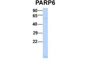 Host:  Rabbit  Target Name:  P Sample Type:  Human MCF7  Antibody Dilution:  1. (PARP6 抗体  (N-Term))
